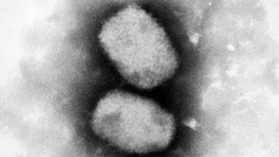 Eine elektronenmikroskopische Aufnahme zeigt das Affenpockenvirus © dpa 