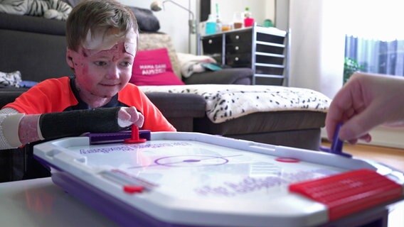 Eine Junge mit Schmetterlingskrankheit beim Spielen. © NDR 
