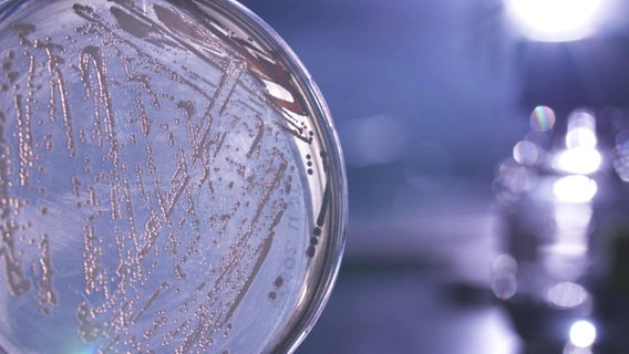 Eine Agarplatte mti Bakterien.  