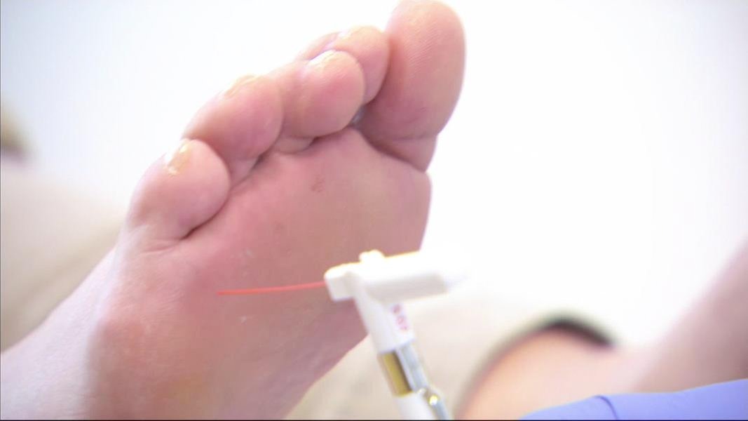 Was Hilft Wirklich Bei Polyneuropathie - Cohomemade