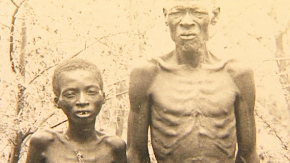 Zwei abgemargerte Menschen aus der ehemaligen Kolonie Deutsch-Südwest-Afrika.  
