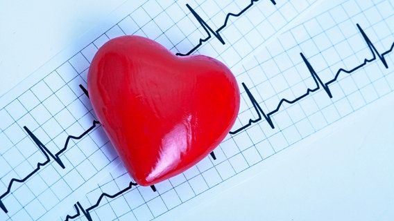 Ritmo cardiaco, ECG © picture-alliance Foto: Graziano G./CHROMORANGE