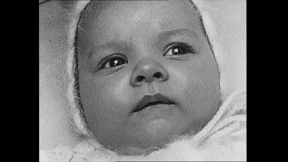 Eine Nahaufnahme von dem Gesicht eines Babys (Archivbild)  