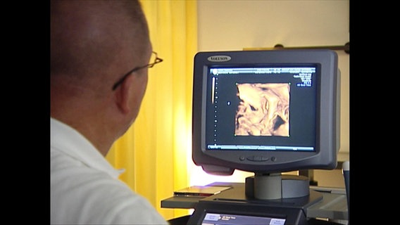 Ein Arzt schaut auf ein Ultraschall-Gerät  