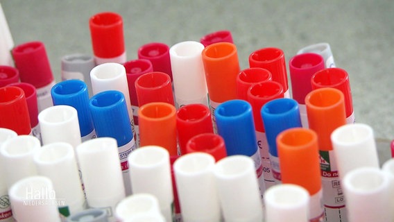 PCR-Test-Proben © Screenshot 