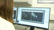 Eine Frau in weißem Laborkittel sitzt am Computer und blickt auf eine Elektronenmikrokopaufnahme eines Präparats. © Screenshot 