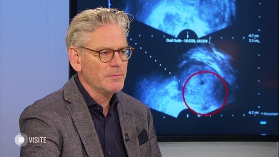 Prof. Markus Graefen von der Martini-Klinik am UKE gibt ein Interview. © Screenshot 
