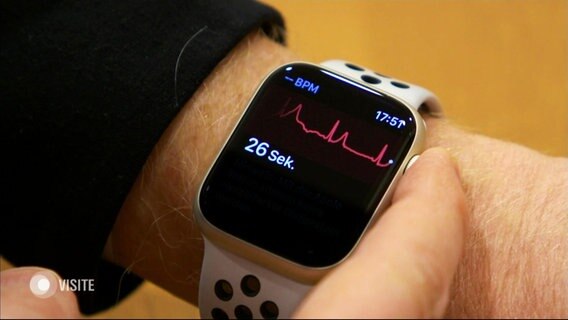 Eine Smartwatch überwacht den Herzrhythmus. © Screenshot 