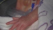Die Hand eines frühgeborenen Babys streicht über ein Handtuch. © Screenshot 