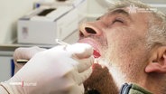 Ein Mann bei der Zahnbehandlung. © Screenshot 