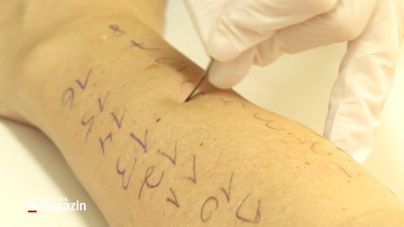Eine Nadel sticht in einen mit Kubelschreiber beschriebenen Arm. © Screenshot 
