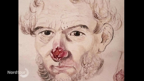 Die Zeichnung eines Mannes mit einer verletzten Nase. © Screenshot 