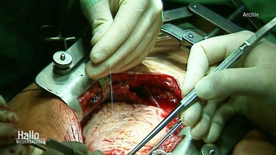 Herz wird operiert. © Screenshot 