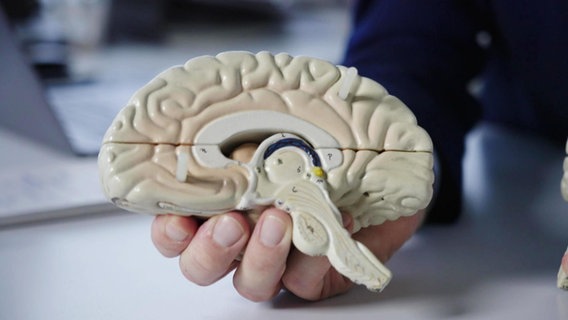Modell eines menschlichen Gehirns. © Screenshot 