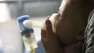 Ein Kleinkind muss wegen Mukoviszidose inhalieren. © Screenshot 