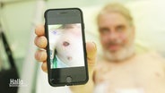 Ein Mann zeigt das Bild einer Brustverletzung auf seinem Smartphone. © Screenshot 