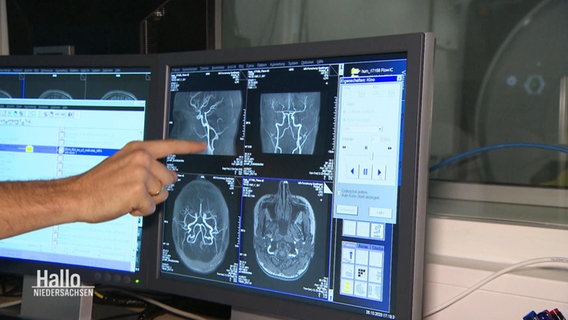 Tomografien eines Hirns auf einem Computerbildschrim. © Screenshot 