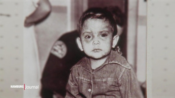 Schwarz-Weiß-Bild eines kleinen Jungen mit blauen Flecken im Gesicht © Screenshot 