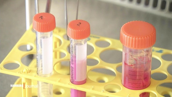 Glasröhrchen mit Proben stehen in einem Labor. © Screenshot 