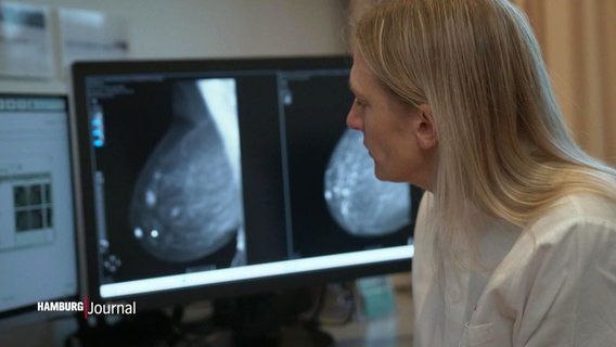 Eine Ärztin betrachtet Röntgenbilder einer Brust. © Screenshot 