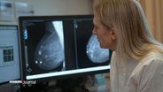 Eine Ärztin betrachtet Röntgenbilder einer Brust. © Screenshot 