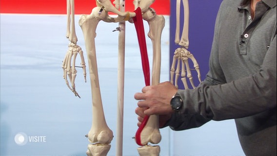 Ein Experte erklärt etwas anhand eines Skelett-Modells. © Screenshot 