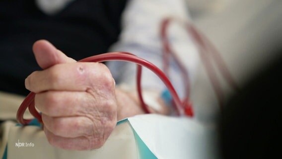 Der Schlauch eines Dialyse-Gerätes steckt in einem Arm eines Patienten. © Screenshot 