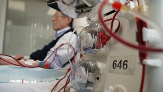 Eine Person an einem Dialyse-Gerät. © Screenshot 