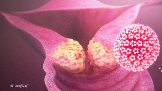 Grafik eines HPV © Screenshot 