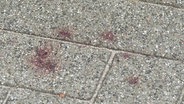 Bluttropfen liegen auf der Straße. © Screenshot 