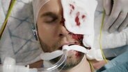 Patient Martin Haage ist an Maschinen angeschlossen, seine linke Gesichtshälfte ist mit einem Verband überdeckt, der bereits blutig ist.  