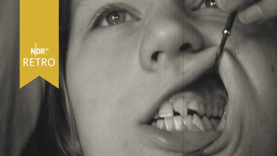Zahnreihe eines Kindes wird beim Zahnarzt begutachtet (1961)  