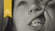 Zahnreihe eines Kindes wird beim Zahnarzt begutachtet (1961)  