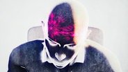 Illustration von Spannungskopfschmerz: Zeichnung eines Menschen ohne Haare. Blick auf den Kopfs von schräg oben. Zwei Punkte, die zu explodieren scheinen, markieren Schmerzpunkte im Stirnbereich. © NDR 