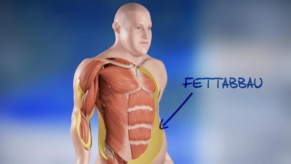 Schematische Darstellung: Arm-, Bauch- und Brustmuskeln © NDR 