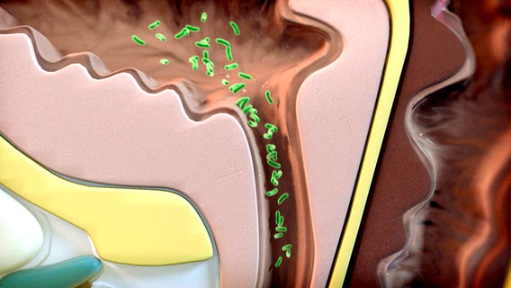 Schematische Darstellung: Bakterien gelangen über die Harnröhre in die Blase. © NDR 