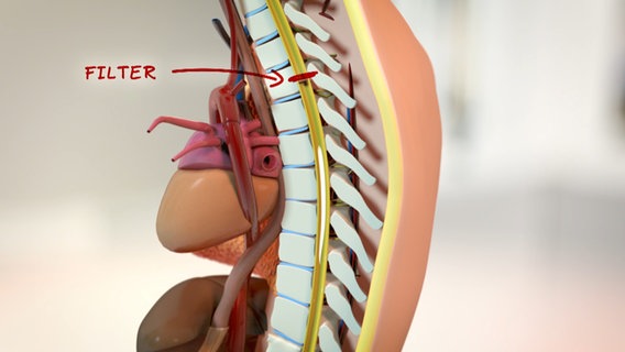 Schematische Darstellung: Rückenmark in der Wirbelsäule. © NDR Foto: tonic trix