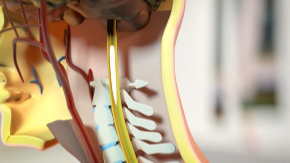 Schematische Darstellung: Schmerzreiz erreicht über das Rückenmark das Gehirn. © NDR Foto: tonic trix