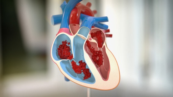 Schematische Darstellung der Herzkammern © NDR 