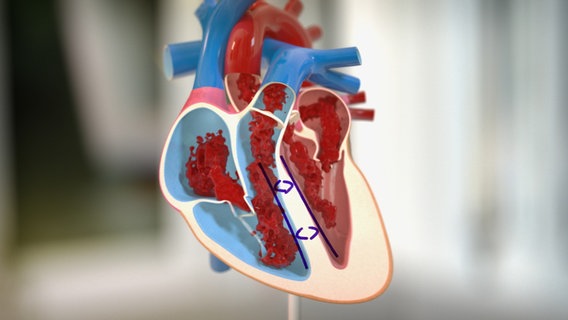 Schematische Darstellung des Herzmuskels © NDR 
