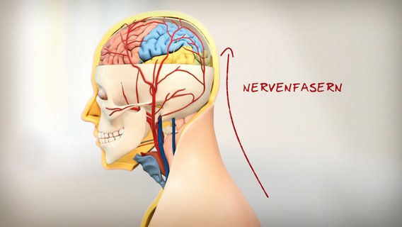 Schematic representation of the head and brain with nerve fibers.  © NDR 