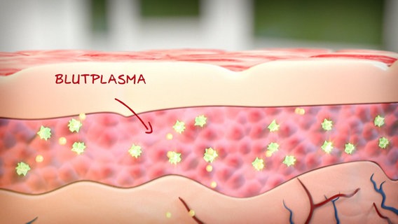 Grafische Darstellung: Hautquarschnitt mit Blutplasma. © NDR 