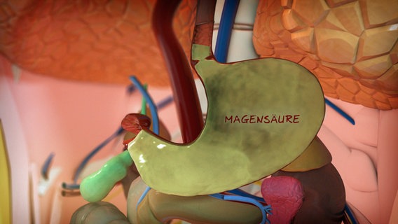 Schematische Darstellung: Magen mit hochsteigender Magensäure. © NDR 