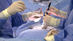 Ärzte verpflanzen eine Bandscheibenprothese. © NDR 