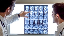 Ärzte besprechen eine MRT-Aufnahme © Fotolia.com Foto: eyetronic