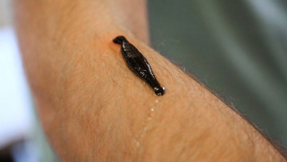 Ein Blutegel sitzt auf einem Arm. © NDR/Labo M GmbH 