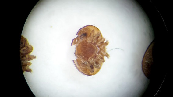 Eine angefressene Varroamilbe unter dem Mikroskop. © NDR 