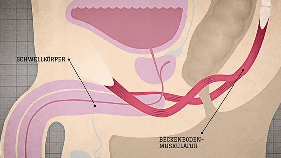 Grafik zeigt im Längsschnitt von der Seite die Beckenregion eines Mannes mit Penis, Harnblase, Beckenbodenmuskulatur und Prostata. © NDR 