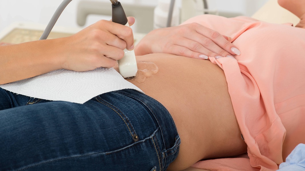 Eine Frau liegt auf einer Liege, ihr Bauch wird mit einem Ultraschallgerät untersucht