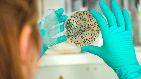 Keime breiten sich in einer Petrischale aus. © NDR 
